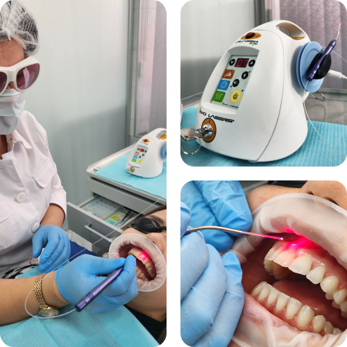 Лазерная стоматология, лазер PICASSO LITE, стоматологический диодный лазер.
