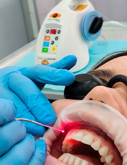 лазерное лечение десен в стоматологии СтомаЭстет